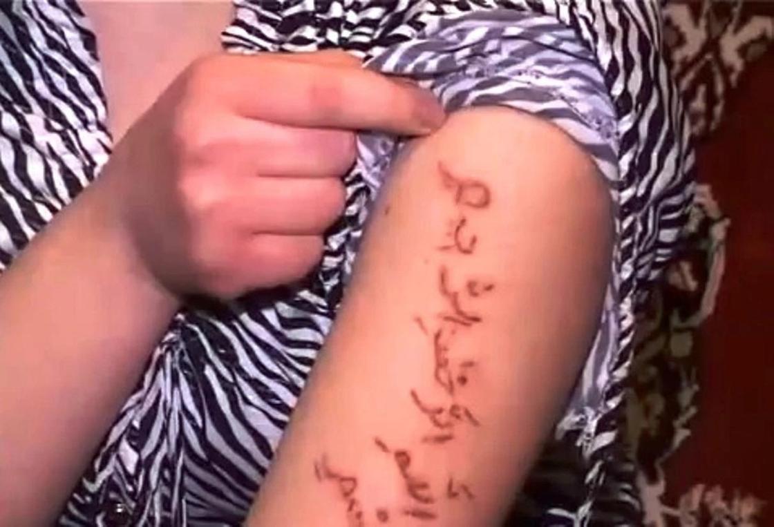 Надписи и Корана появились теле больной девушки в Кызылорде (видео)