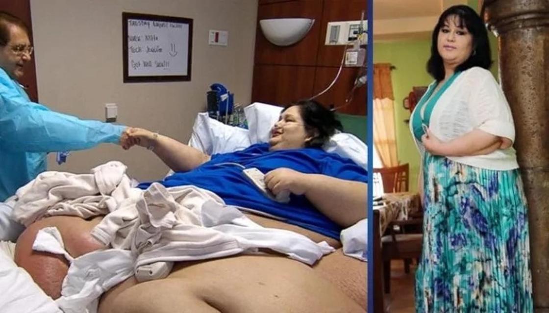 Шокирующее похудение: женщина сбросила 400 кг