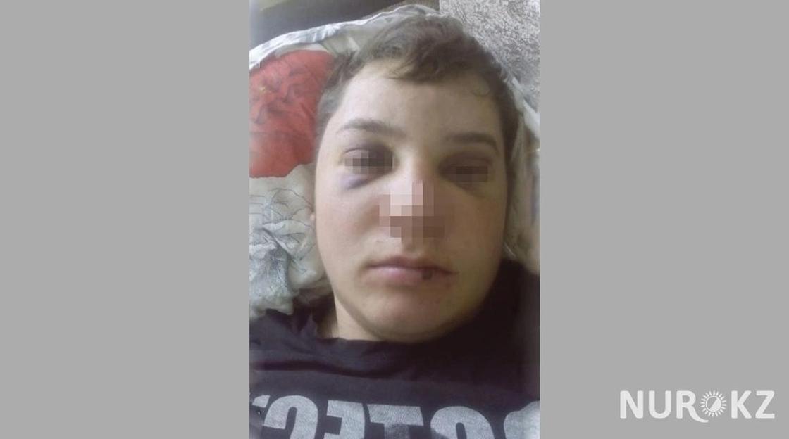 Житель Карагандинской области обвинил полицейских в избиении (фото)