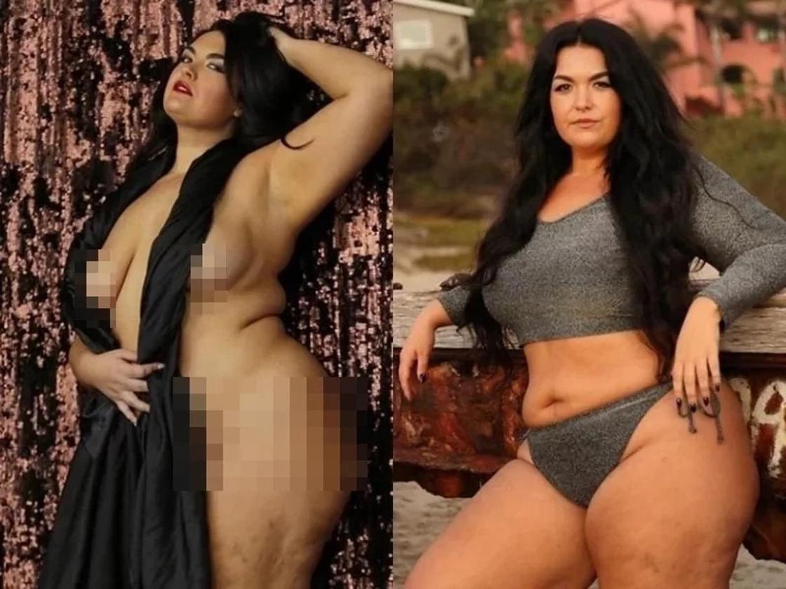 Девушка с редкой болезнью стала Instagram-сенсацией, показав свое голое тело (фото 18+) Девушка с редкой болезнью стала Instagram-сенсацией, показав свое голое тело (фото 18+)