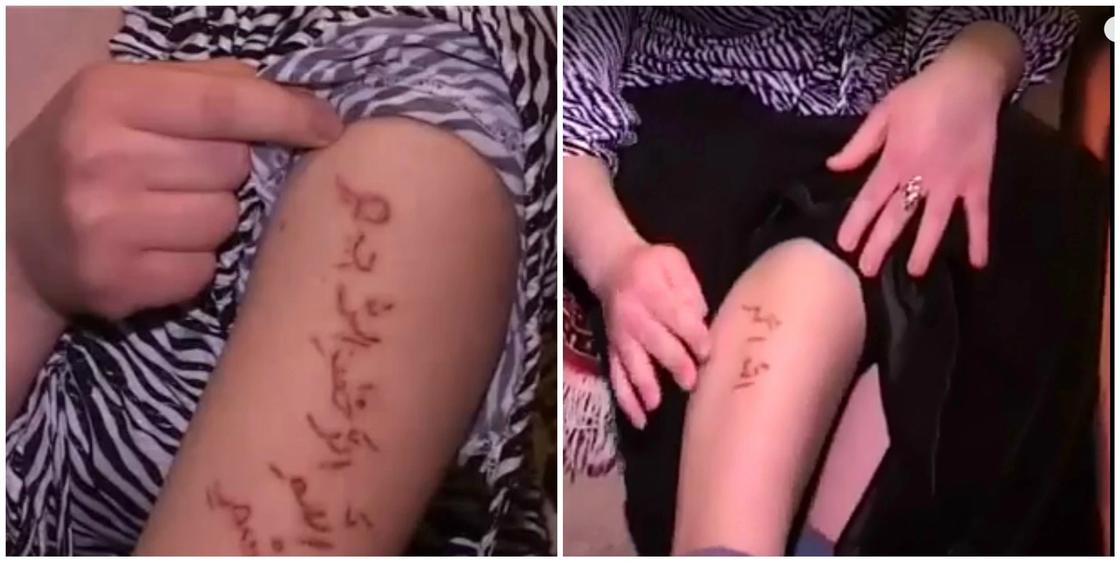 Надписи и Корана появились теле больной девушки в Кызылорде