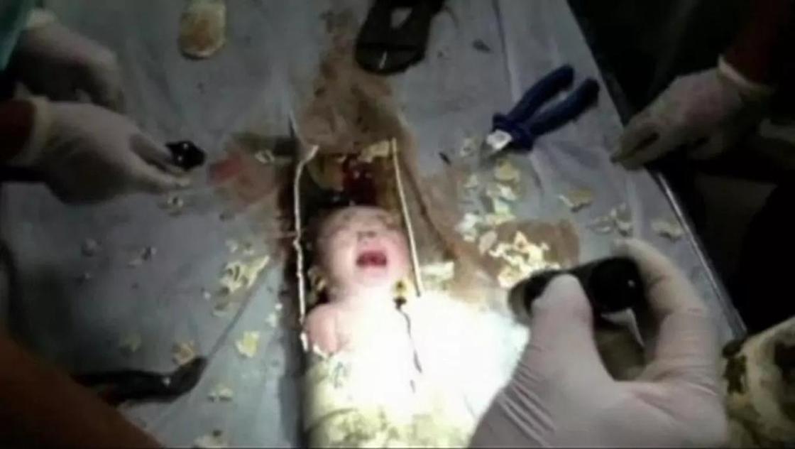Новорожденного ребенка спасли из канализации в Индии