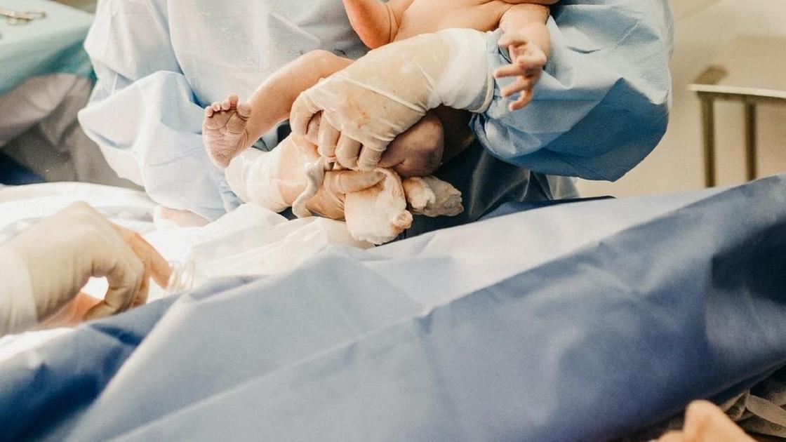 Врачи принимают роды