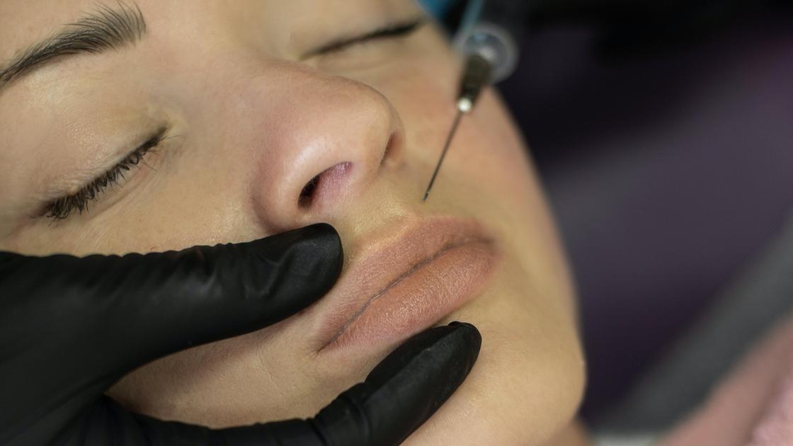 Косметолог делает укол в губы