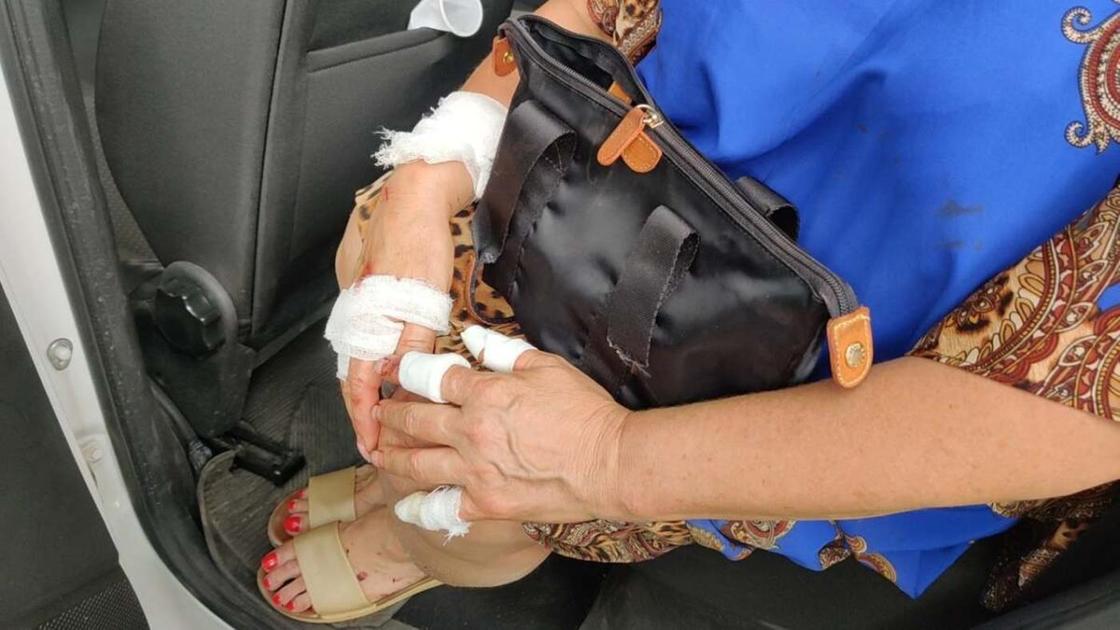Раненая пенсионерка держит в руках сумку