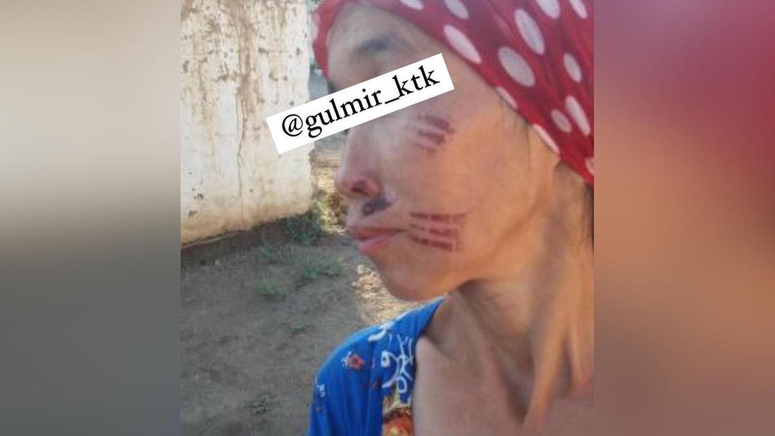 Женщина с "клеймом" в Туркестанской области