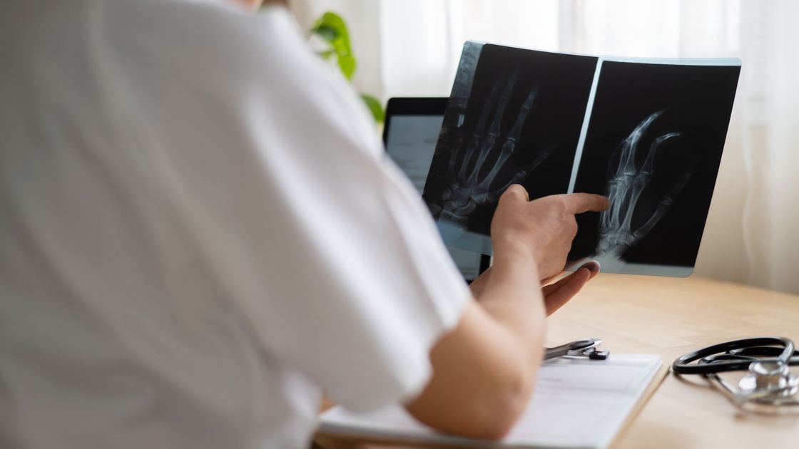 Врач смотрит рентген