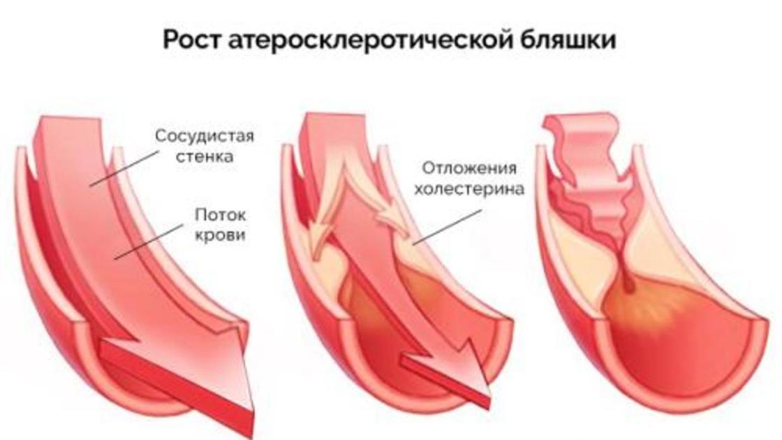 как и чем почистить кровь и сосуды. 529e9f37d23d25c6. как и чем почистить кровь и сосуды фото. как и чем почистить кровь и сосуды-529e9f37d23d25c6. картинка как и чем почистить кровь и сосуды. картинка 529e9f37d23d25c6.