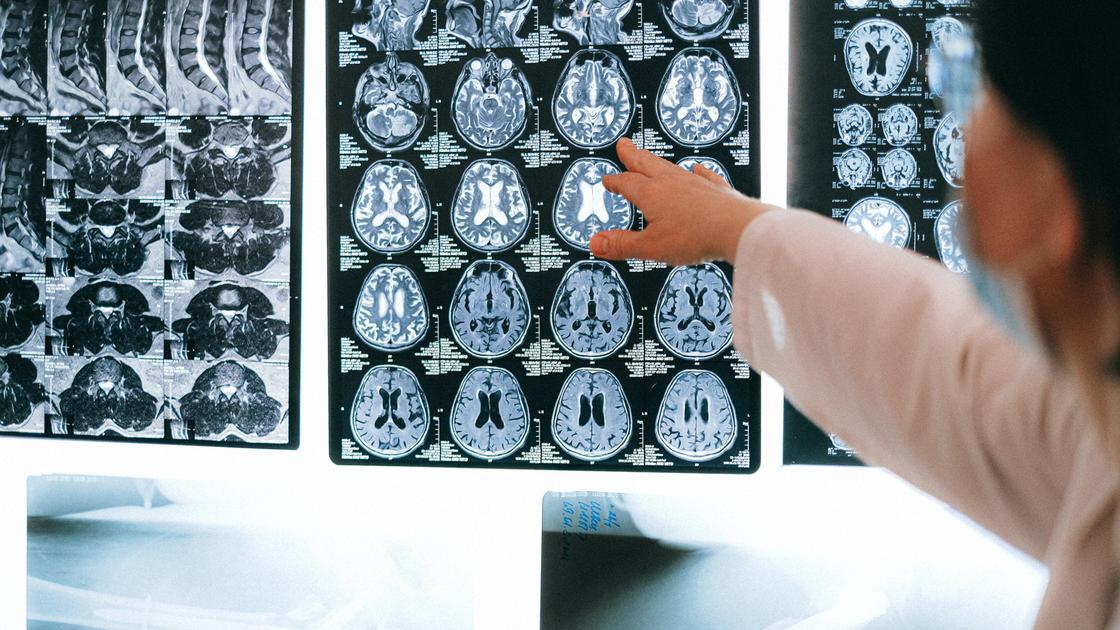Нейрохирург и томография головного мозга
