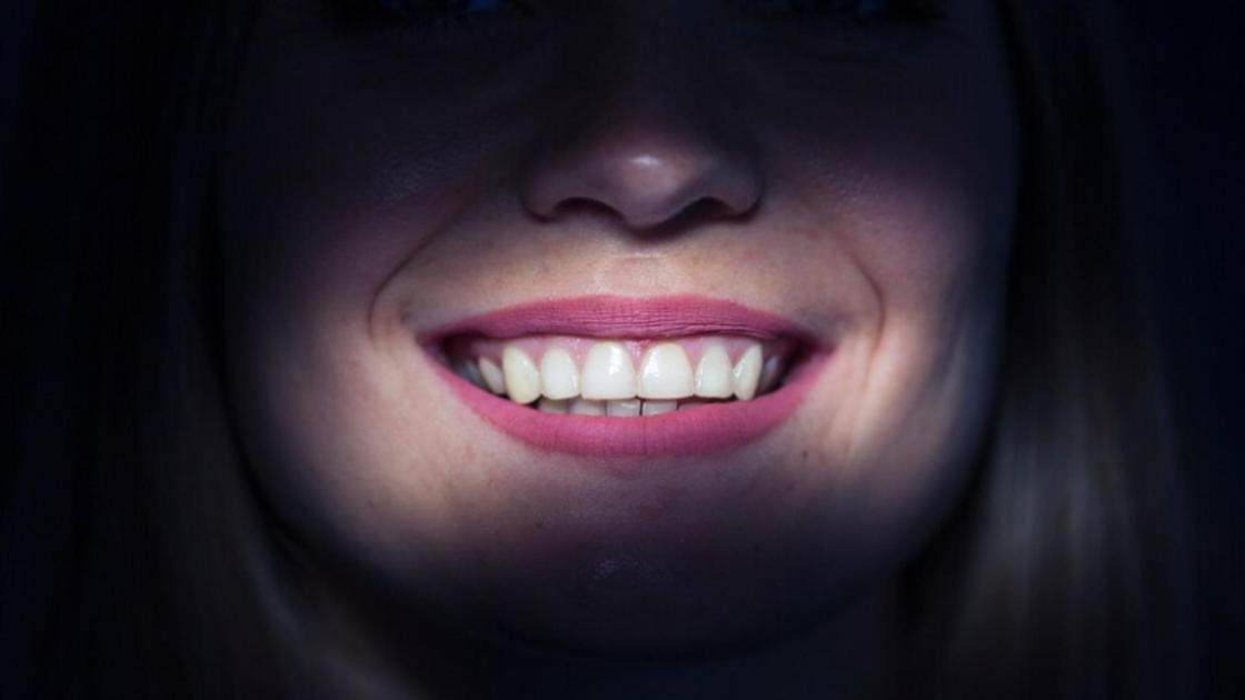 Красивые женские зубы