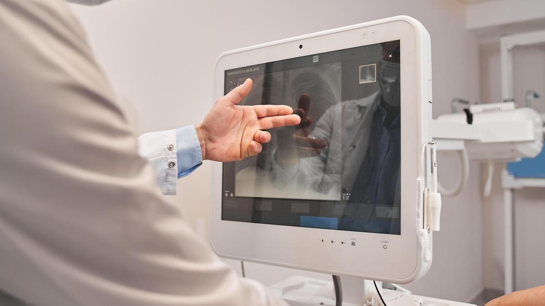 Исследование легких