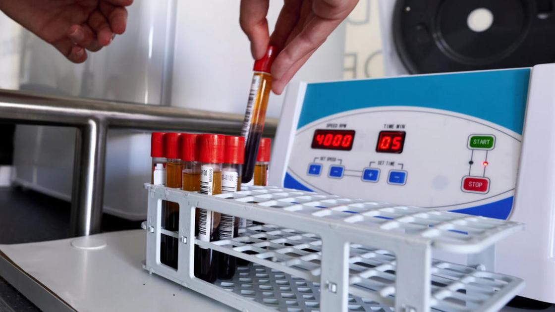 Лаборант ставит пробирку с кровью в органайзер для пробирок