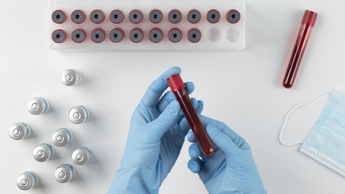 Как повысить лейкоциты в крови: самые эффективные методы