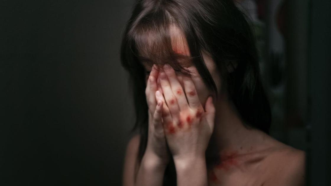 Девушка с кровоподтеками на руках закрывает лицо