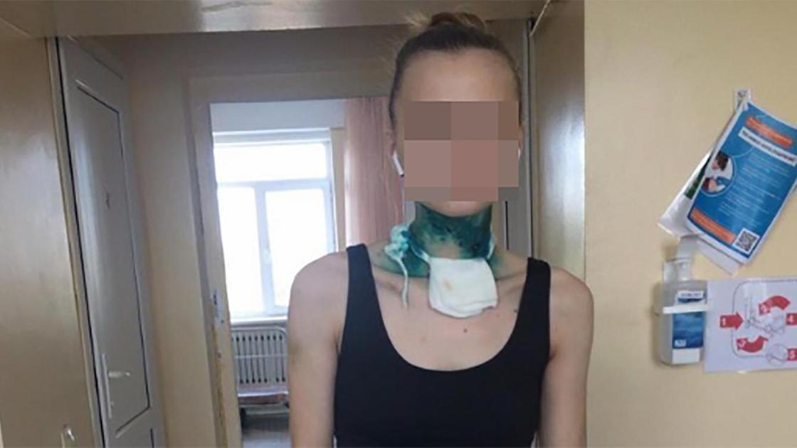 Девушка с порезанной шее находится в больнице