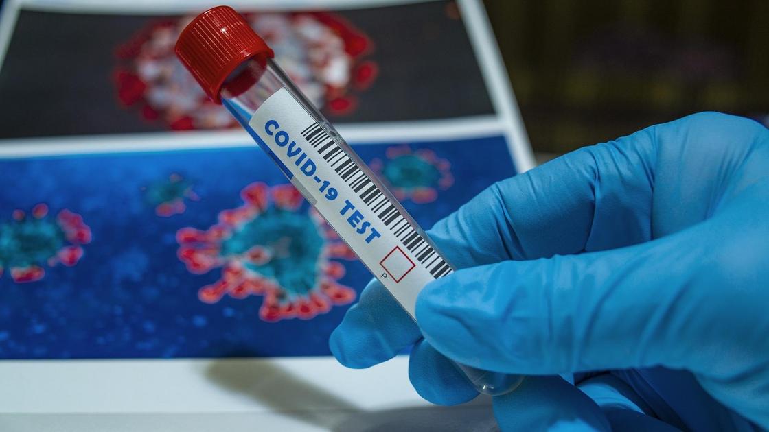 медик держит в руке тест на коронавирус