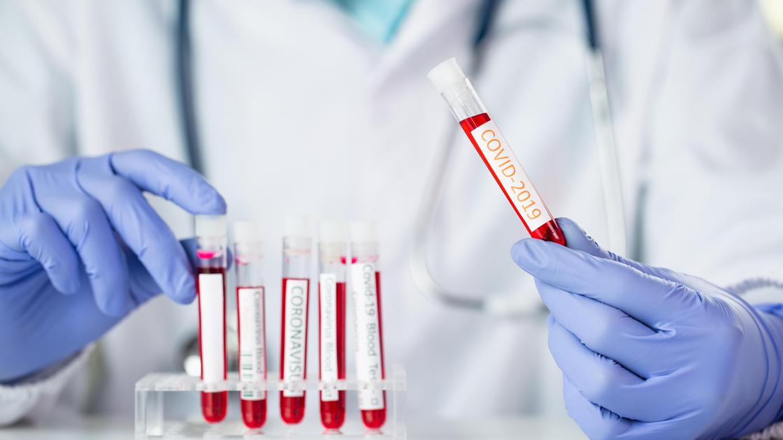 Доктор держит в руке пробирку с пробой на вирус