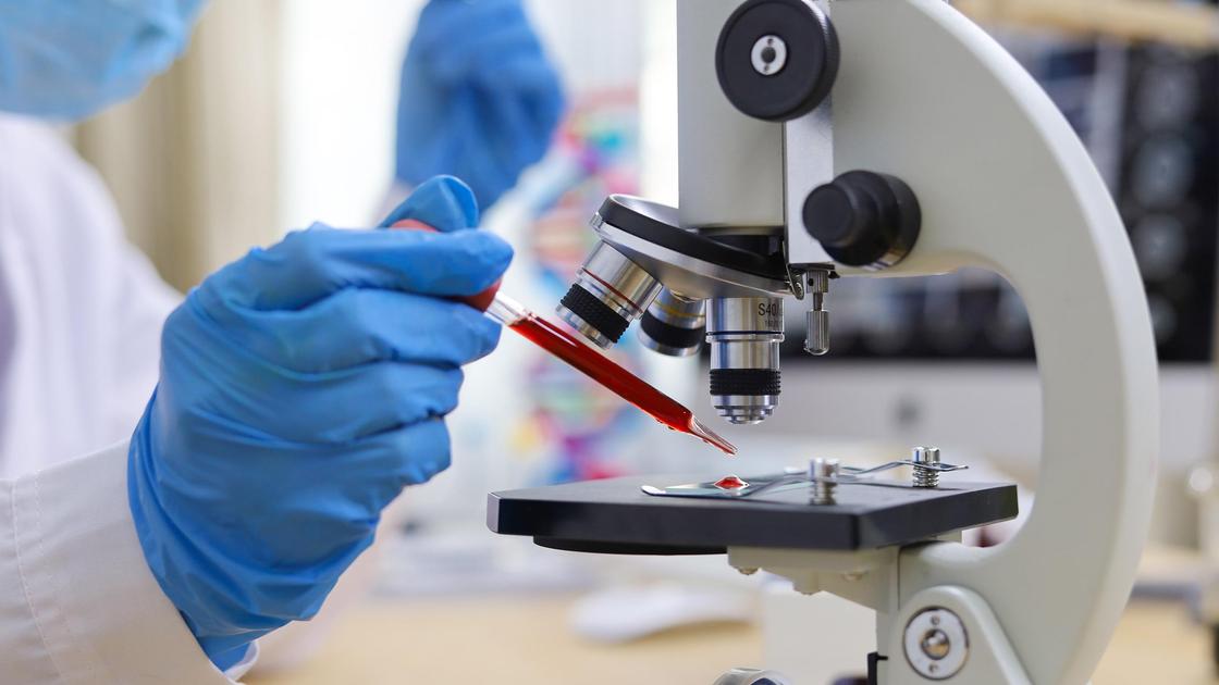 Медик наносит пробу крови для рассмотрения под микроскопом