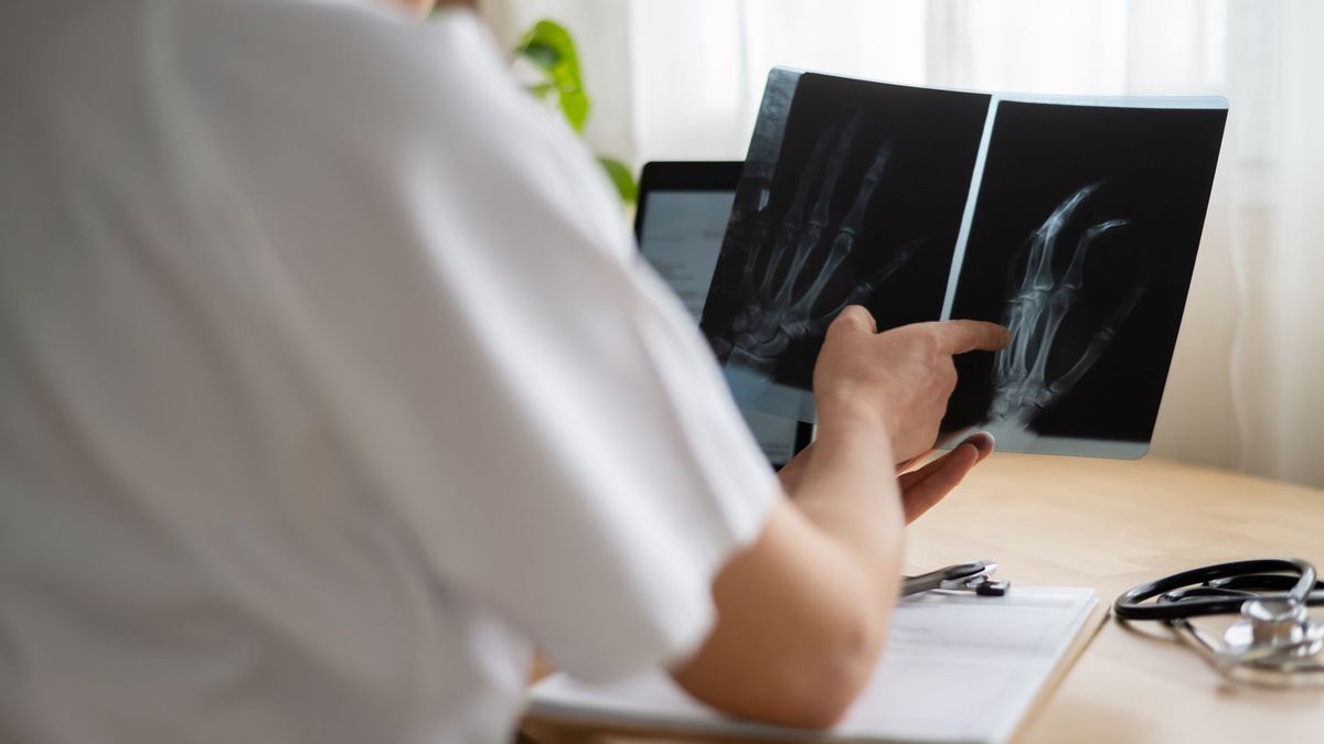 Врач смотрит рентген