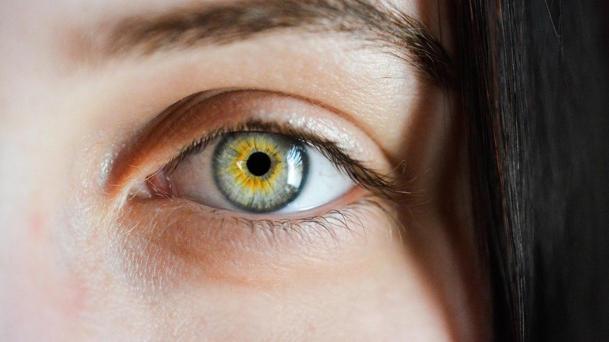 Девушка с желтыми глазами