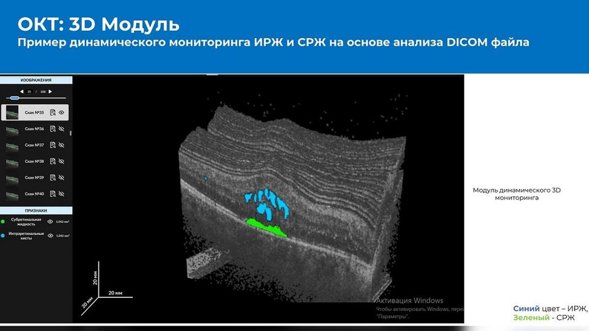 Пример динамического мониторинга ИРЖ и СРЖ на основе анализа DICOM файла