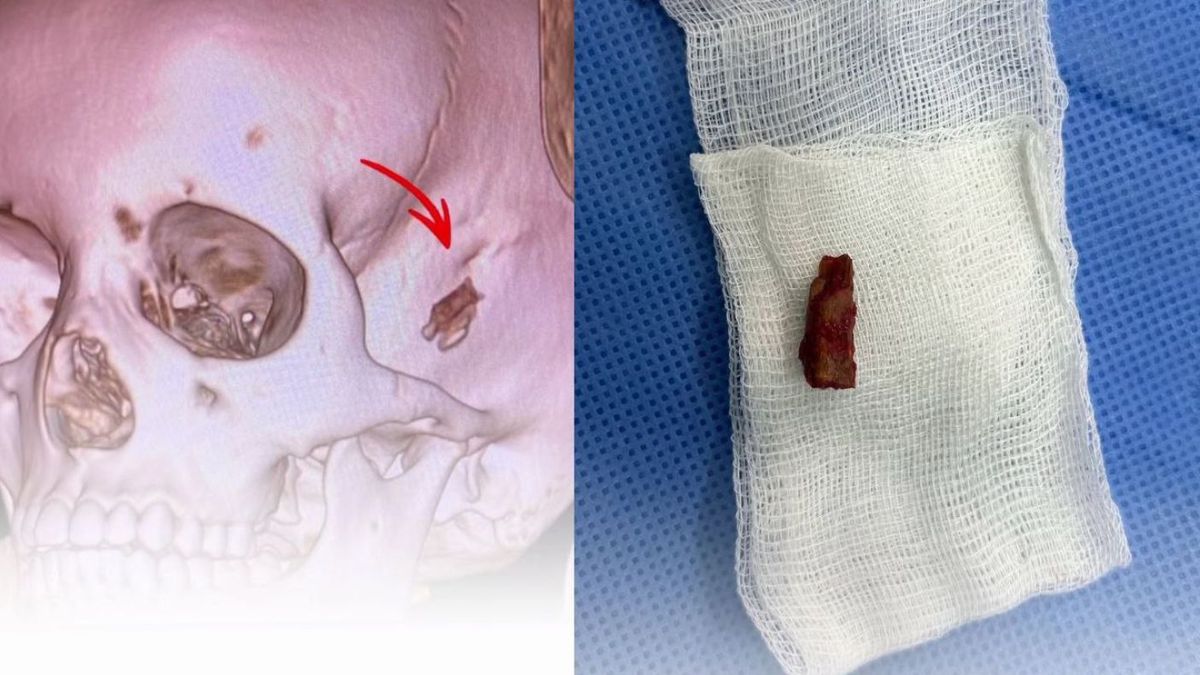 Обломок ветки