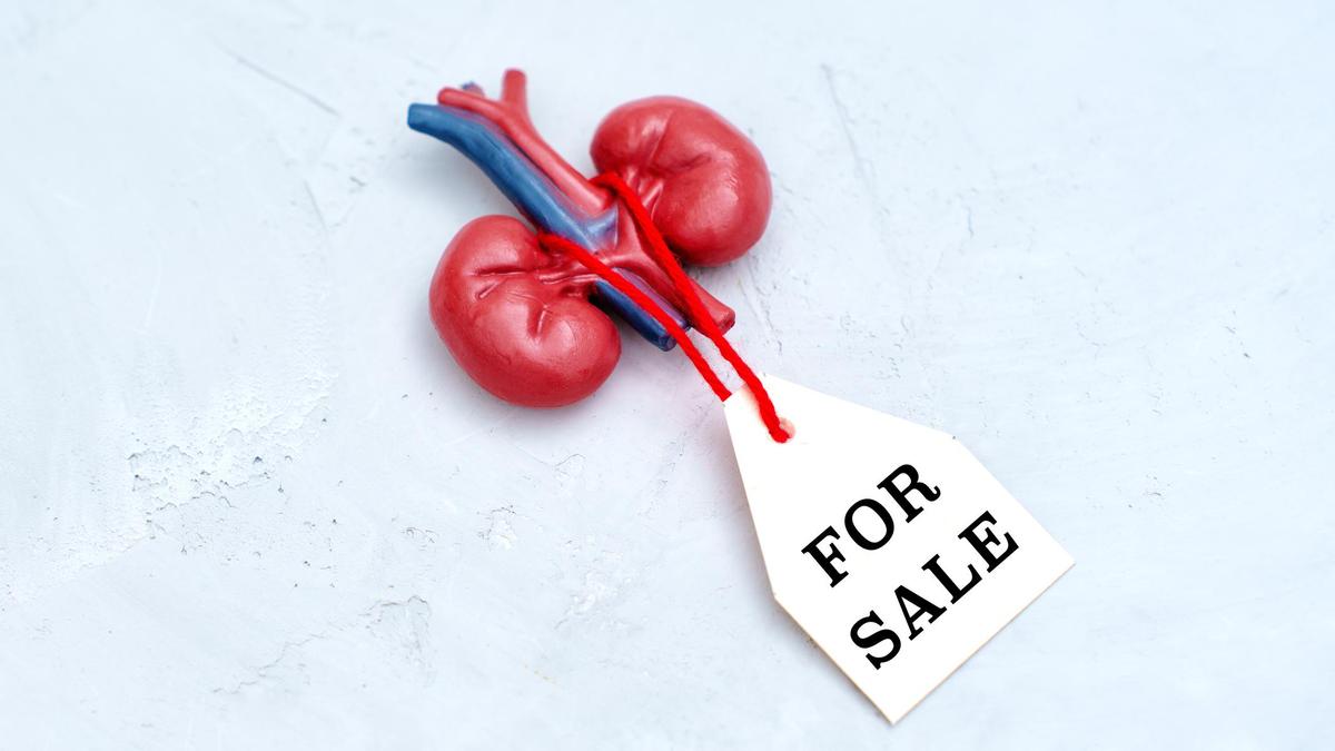 Продажа органов Продажа органов