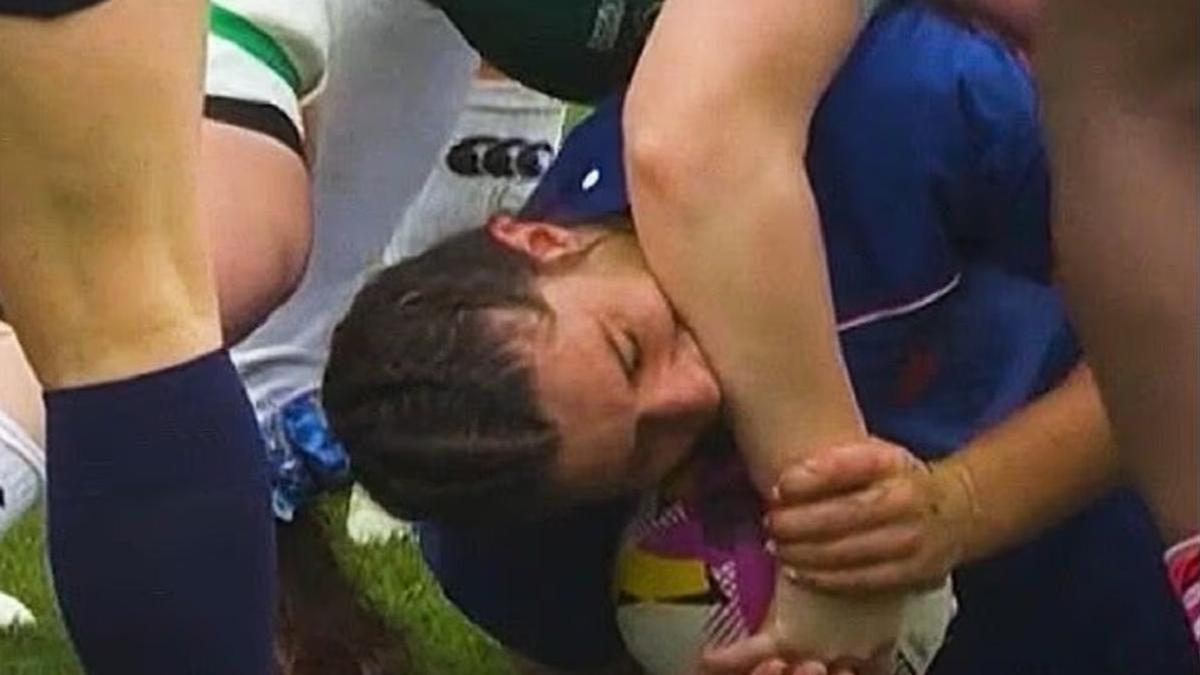 Укус во время матча