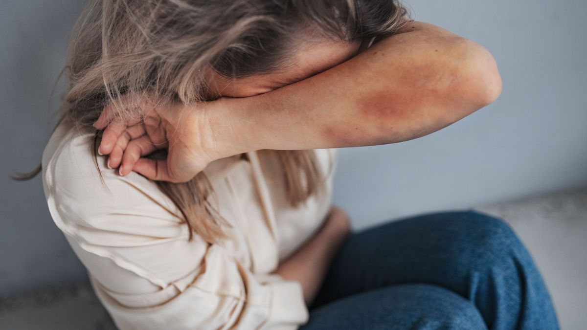 Женщина с синяками