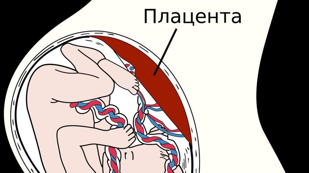 Что такое плацента у беременных женщин. Прикрепление пуповины к плаценте. Пуповина прикреплена к краю плаценты.