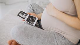 Беременная женщина держит в руках снимки УЗИ