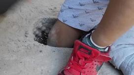 Нога мальчика, застрявшая в бетонной плите