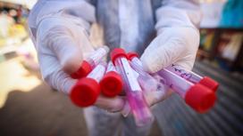 медик держит в руке тесты на коронавирус