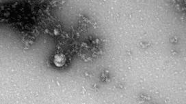 Снимок британского штамма коронавируса