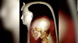 3500-летняя мумия Аменхотепа I