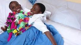 Знаменитые сиамские близнецы из Танзании умерли в возрасте 22 лет