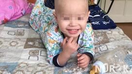 Двухлетний казахстанец не мог сходить в туалет из-за опухоли