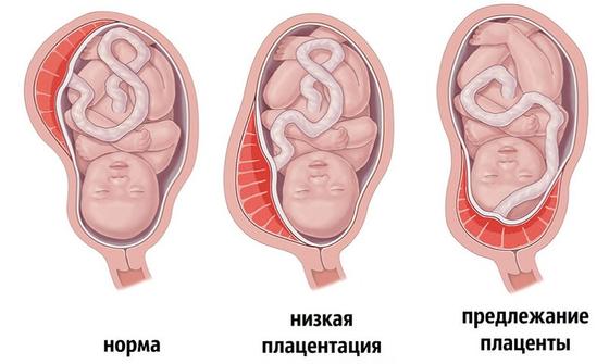 Плацента Плацента