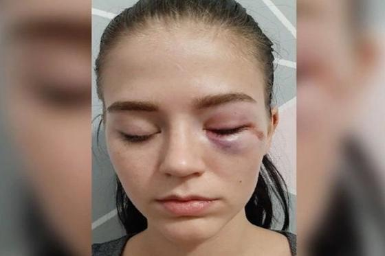 Көліктің қақпағына басын ұрған: Алматыда ер адам аруларды соққыға жықты Көліктің қақпағына басын ұрған: Алматыда ер адам аруларды соққыға жықты