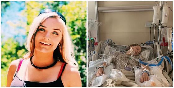 18-летняя девушка оказалась в коме и чуть не умерла из-за вейпа 18-летняя девушка оказалась в коме и чуть не умерла из-за вейпа