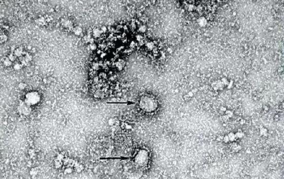 Жаңа коронавирустың микроскоп көмегімен жасалған суреті. Фото: The Chinese disease prevention authority Жаңа коронавирустың микроскоп көмегімен жасалған суреті. Фото: The Chinese disease prevention authority