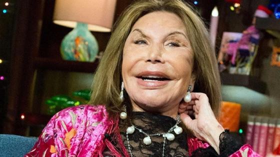 Умерла рекордсменка по пластическим операциям и звезда телешоу в США Умерла рекордсменка по пластическим операциям и звезда телешоу в США