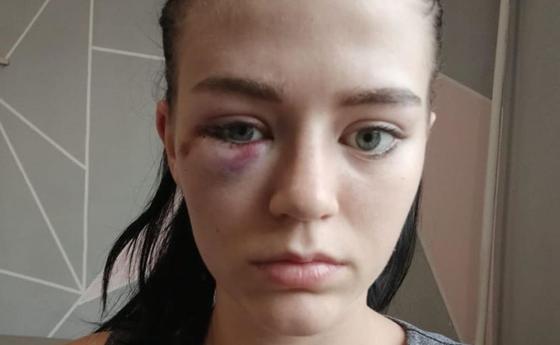Девушек жестоко избили в центре Алматы Девушек жестоко избили в центре Алматы