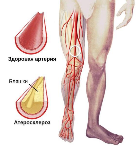 Блишки Блишки