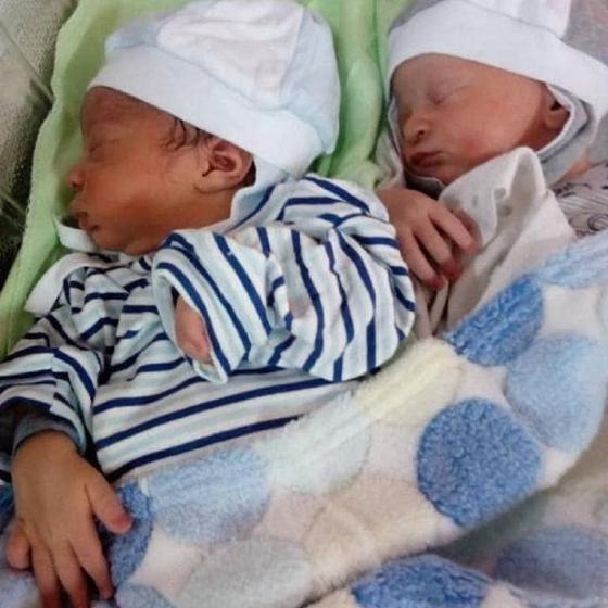 Келіншек терісінің түсі әртүрлі егіздерді дүниеге әкелген Келіншек терісінің түсі әртүрлі егіздерді дүниеге әкелген