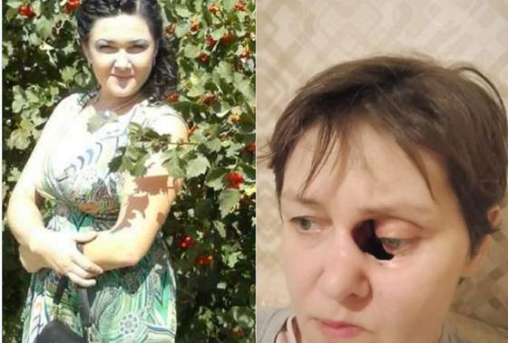 Женщина гниет заживо в Актобе, и никто не знает почему Женщина гниет заживо в Актобе, и никто не знает почему