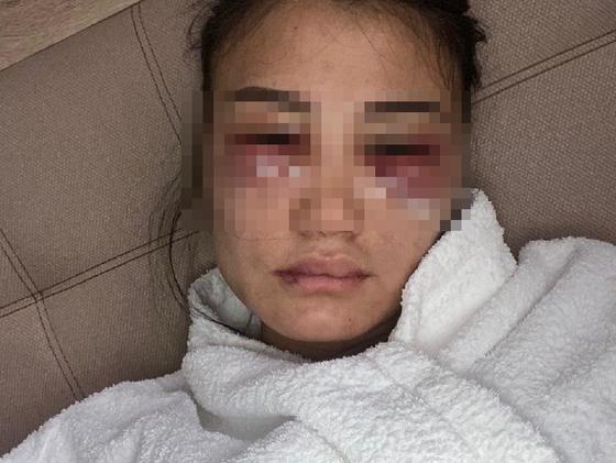 "Не могу молчать" : алматинка заявила, что год терпит побои от парня и боится за свою жизнь "Не могу молчать" : алматинка заявила, что год терпит побои от парня и боится за свою жизнь