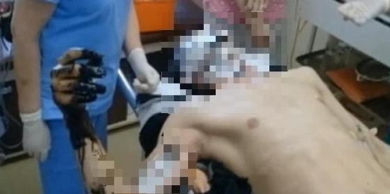 Учитель обварился гудроном в Акмолинской области: ситуацию прокомментировали в управлении образования Учитель обварился гудроном в Акмолинской области: ситуацию прокомментировали в управлении образования