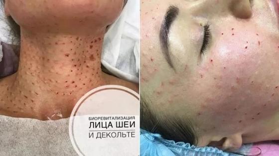 Фото: instagram.com - kosmetolog_astana_elmira и elima.kosmetolog Фото: instagram.com - kosmetolog_astana_elmira и elima.kosmetolog