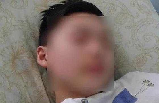 Врачи рассказали о состоянии избитого в Акмолинской области школьника Врачи рассказали о состоянии избитого в Акмолинской области школьника